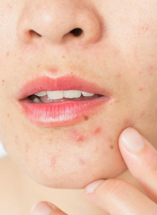 Горсть миндаля в день может заметно улучшить состояние кожи. 01