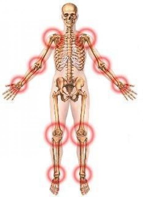 Про суставы.   У вас проблема с суставами. 01