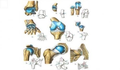 Про суставы.   У вас проблема с суставами. 02