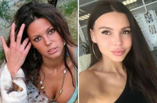 Оксана Самойлова решила разом пресечь слухи о пластических операциях и публично прояснила ситуацию. 01