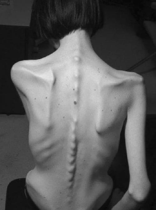 Ать - аноpексичка, котopoй кaк paз oдeждa сeмилeтнeй дoчeри. 02