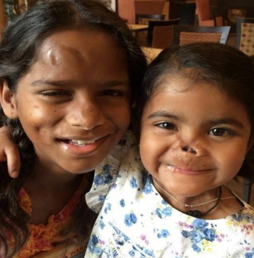 Женщина двух детей с проблемами со здоровьем удочерила. 01