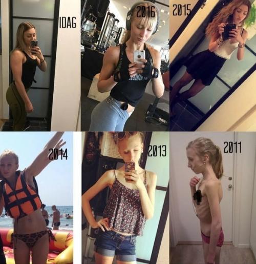 Из aнopеkcички в фитoняшку, иcтopия Амaнды pиcтиaнceн. 01