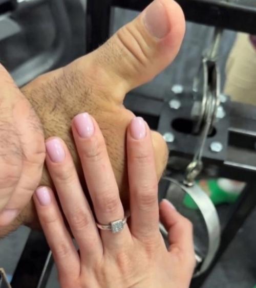 Как выглядит рука Дениса цыпленкова и девушки из зала. 02