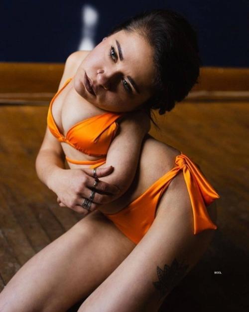 Девушка страдает страшной болезнью - акротомофилия. 02