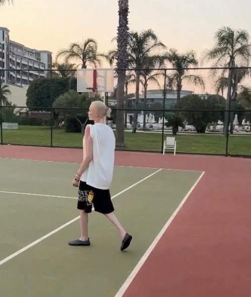 Алену Шишкову снова подозревают в анорексии. 02 Алену Шишкову снова подозревают в анорексии. 02