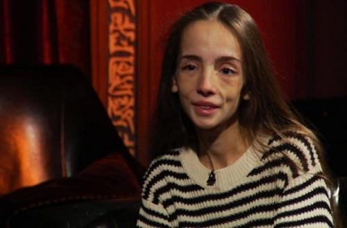 Какой результат!  Девушка умничка, смогла побороть анорексию! 01