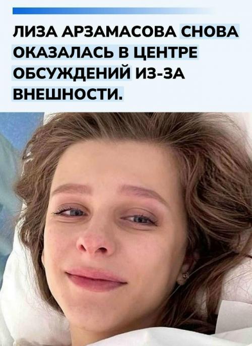 В сети продолжают обсуждать изменения во внешности актрисы. 

