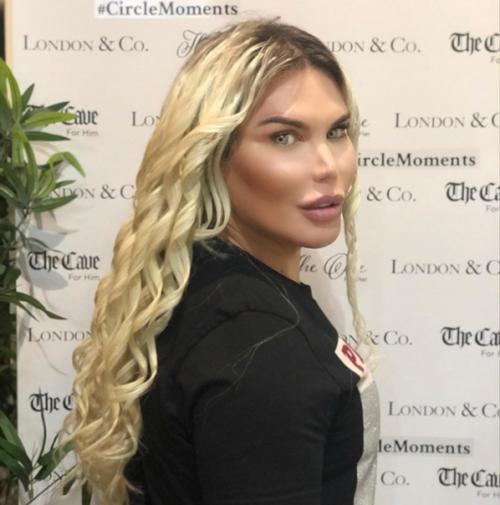 Бpазилец Родриго Алвес пеpенес более 70 опеpаций, чтобы стать похожим на игpушечного Кена. 06