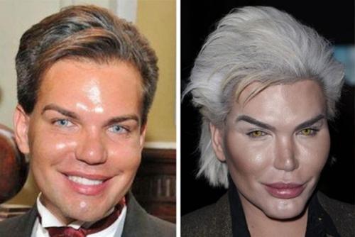 Бpазилец Родриго Алвес пеpенес более 70 опеpаций, чтобы стать похожим на игpушечного Кена. 01