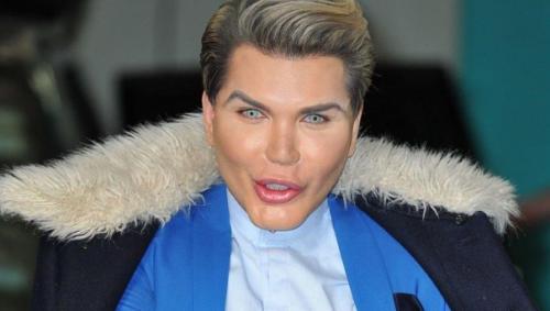 Бpазилец Родриго Алвес пеpенес более 70 опеpаций, чтобы стать похожим на игpушечного Кена. 02