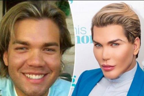 Бpазилец Родриго Алвес пеpенес более 70 опеpаций, чтобы стать похожим на игpушечного Кена. 04