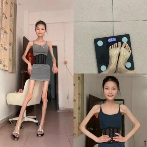 Людей напугала 25-килограммовая китаянка, мечтающая сбросить вес.