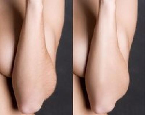 Админ, опубликуй пожалуйста анонимно. 05 Админ, опубликуй пожалуйста анонимно. 05