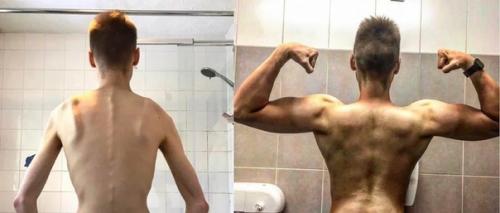 Мне Говорили, у Мужчин не Бывает Анорексии. 02