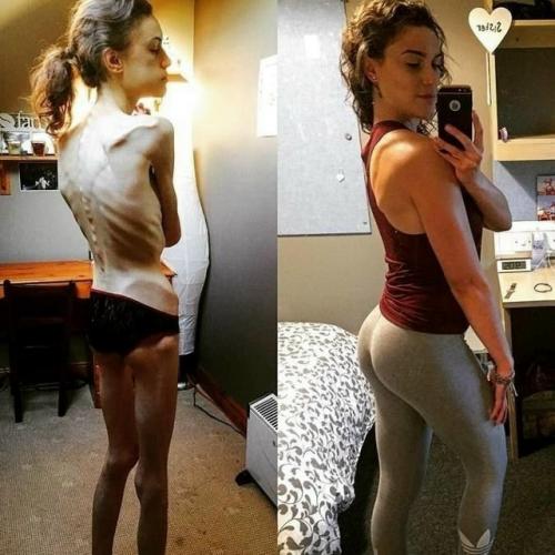 Путь эмел Льюис - это не просто история похудения и набора веса, это история возвращения к жизни. 02