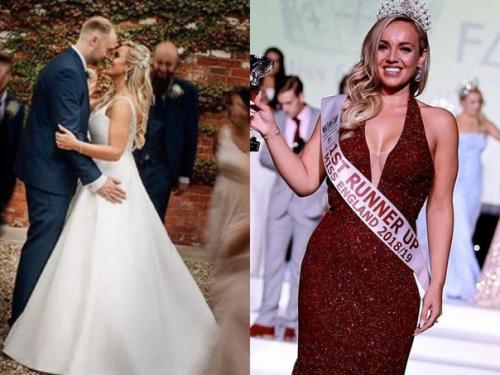 26-Летняя англичанка весила 108 килограмм. 03