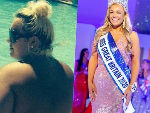 26-Летняя англичанка весила 108 килограмм. 04