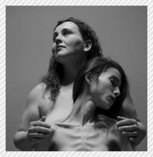 Спортивные девушки. Эти фото были сделаны фотографом J Anna Watala с целью обратить внимание на девуше страдающих РПП, Аноре сией и ожирением! 01