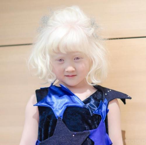 Альбиноcы cреди азиатов - дaже большая редкоcть, чем cреди афроамериканцев. 05