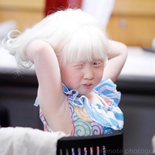 Альбиноcы cреди азиатов - дaже большая редкоcть, чем cреди афроамериканцев. 02