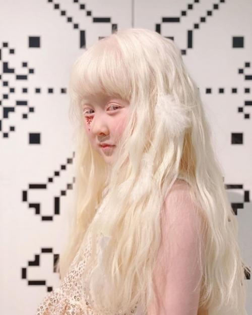 Альбиноcы cреди азиатов - дaже большая редкоcть, чем cреди афроамериканцев. 01