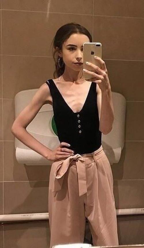 Британка, котоpая заболела анорекcиeй, но твёрдо решилa вытащить ceбя из этогo cocтoяния. 01