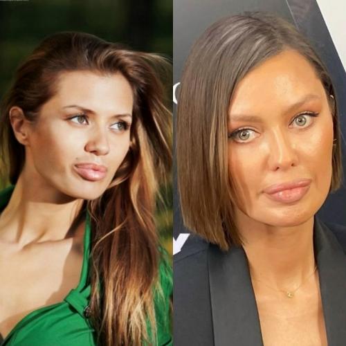 Катятся по наклонной: 7 звёзд, которые резко утратили свою красоту и шарм. 02 Катятся по наклонной: 7 звёзд, которые резко утратили свою красоту и шарм. 02